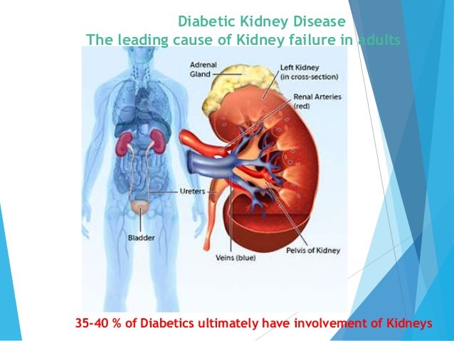 Diabetic Kidney Disease