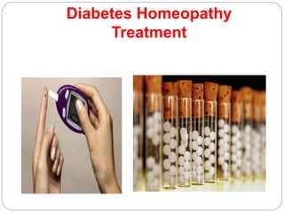 Diabetes Homeopathy
Treatment
 
