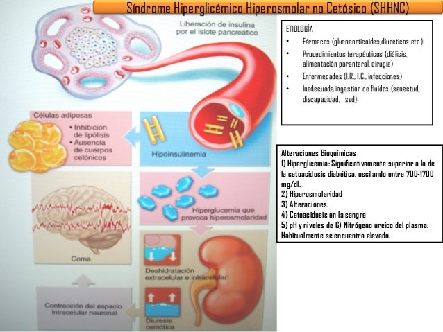 diabetes en estadio 1 infantil