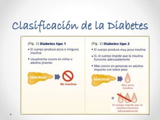 Clasificación de la Diabetes 
 