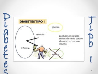 Tip
o
I
Diabete s
