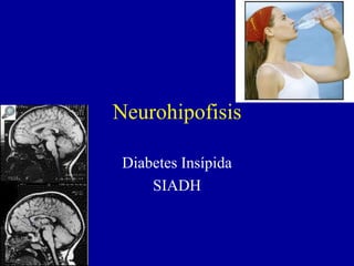 Neurohipofisis
Diabetes Insípida
SIADH
 