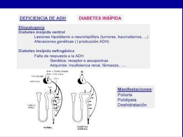 diabetes insípida fisiopatología central de l diabetes insípida fisiopatología central de l
