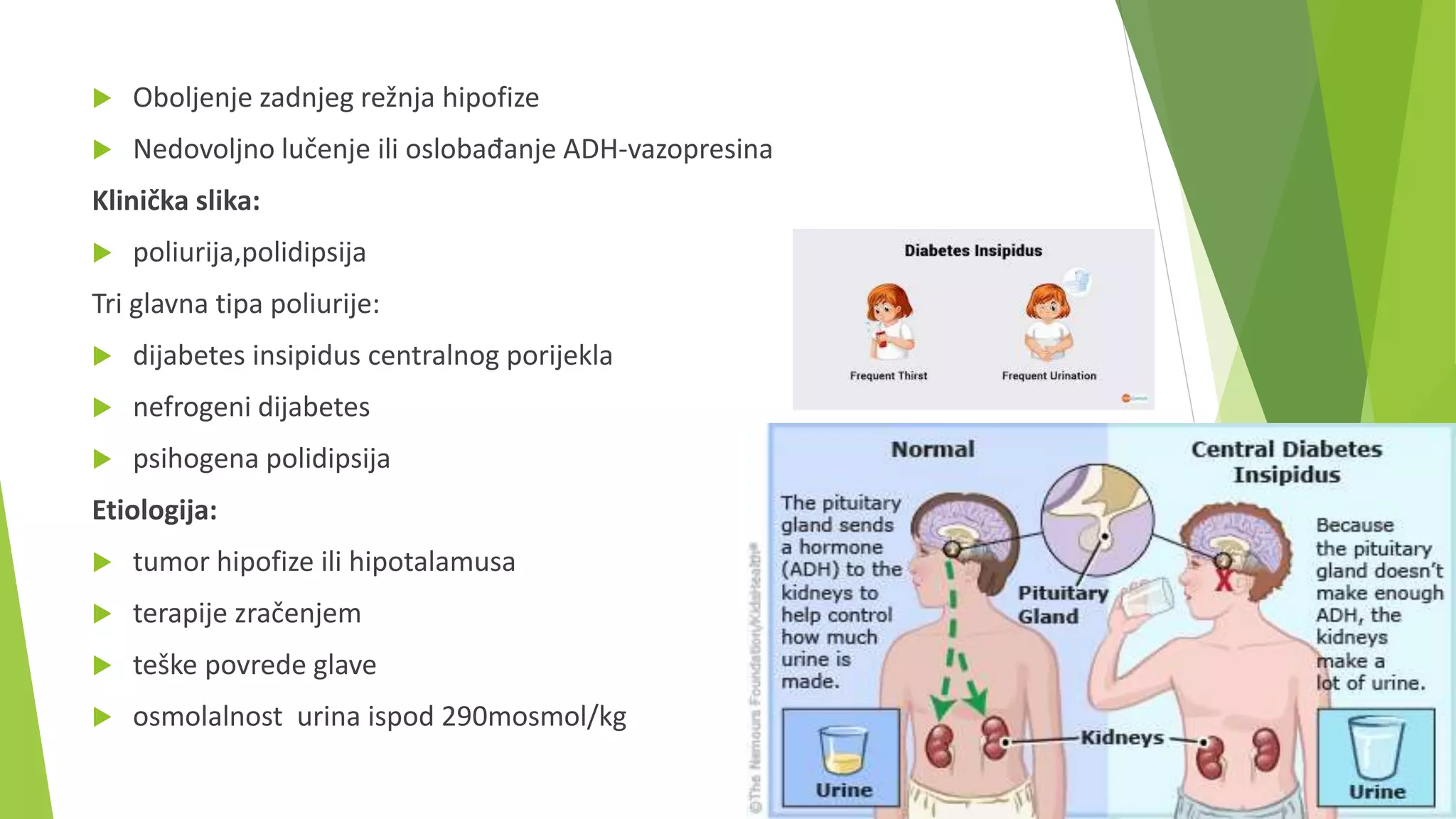 Diabetes insipidus | PPTX