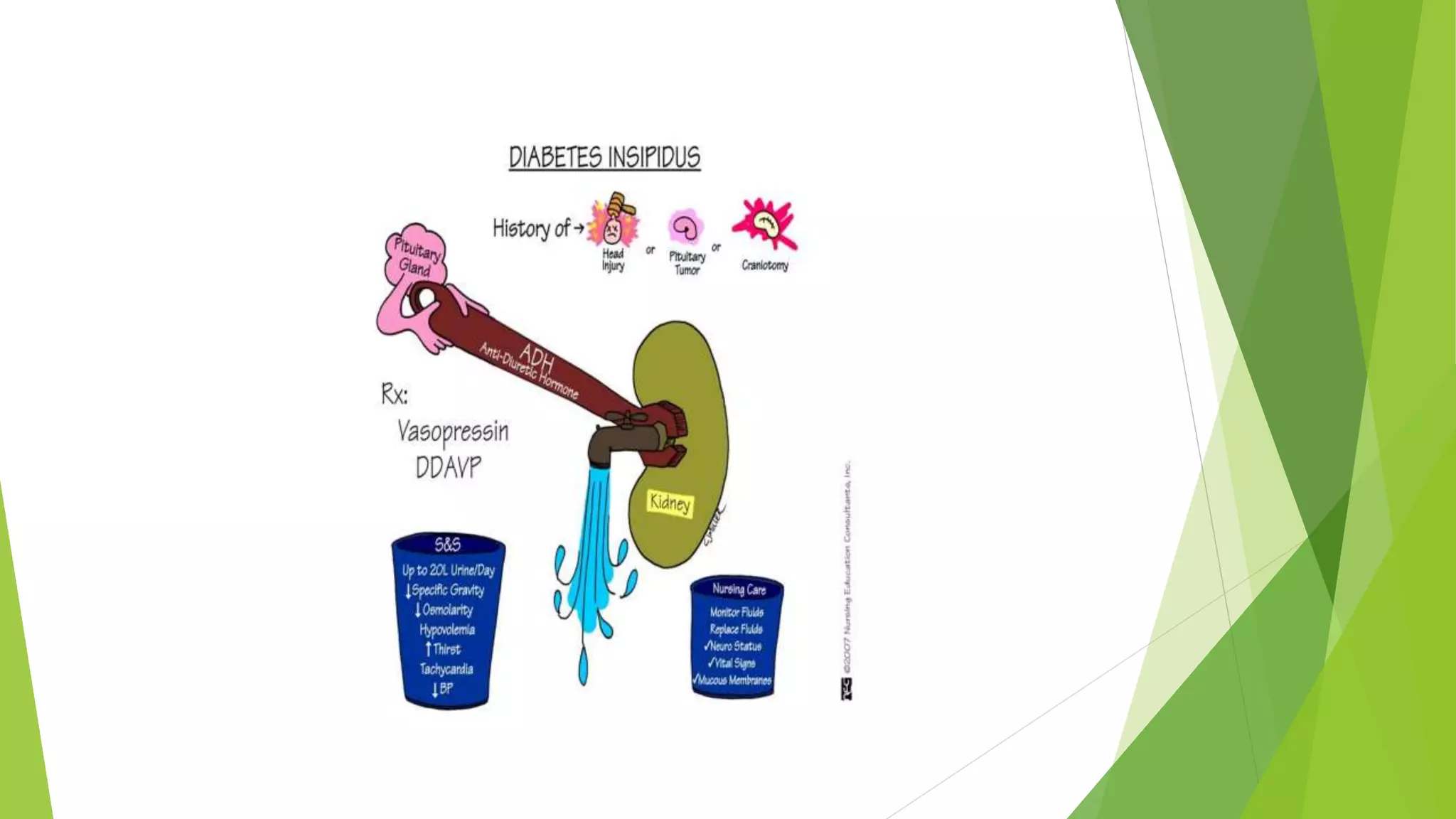 Diabetes insipidus | PPTX
