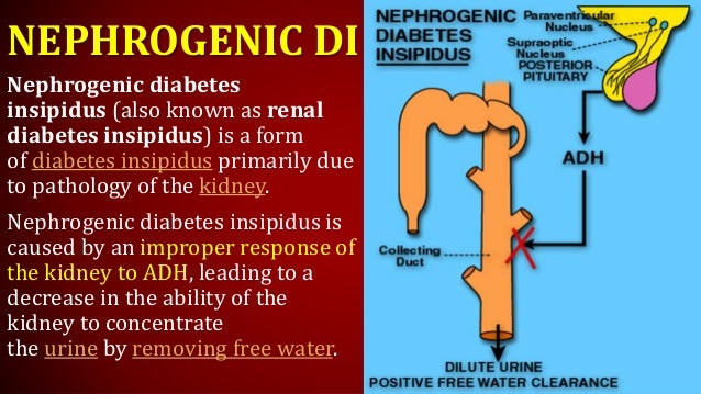 Diabetesinsipidus Vzroki In Simptomi 5 Naravnih Diabetesinsipidus Vzroki In Simptomi 5 Naravnih