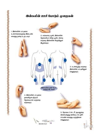 Diabetes Education_Tamil_Isha Arokiya Alai