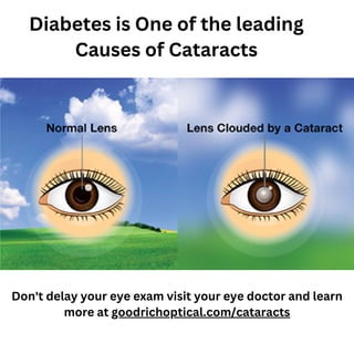 Diabetes is One of the leading
Causes of Cataracts
Don't delay your eye exam visit your eye doctor and learn
more at goodrichoptical.com/cataracts
 