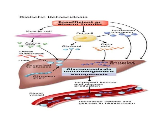 diabetic ketoacidosis Diabetic ketoacidosis is a life-threatening complication of type 1 diabetes (though rare, it can occur in people with type 2 diabetes) that occurs when the body produces high levels of ketones due to lack of insulin diabetic ketoacidosis occurs when the body cannot produce enough insulin the signs and symptoms of diabetic ketoacidosis include. diabetic ketoacidosis Diabetic ketoacidosis is a life-threatening complication of type 1 diabetes (though rare, it can occur in people with type 2 diabetes) that occurs when the body produces high levels of ketones due to lack of insulin diabetic ketoacidosis occurs when the body cannot produce enough insulin the signs and symptoms of diabetic ketoacidosis include.