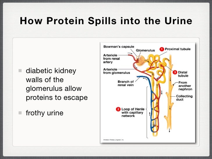Protecting the Kidney in Diabetes