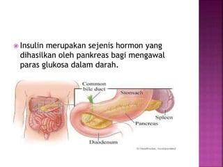  Insulin merupakan sejenis hormon yang
dihasilkan oleh pankreas bagi mengawal
paras glukosa dalam darah.
 