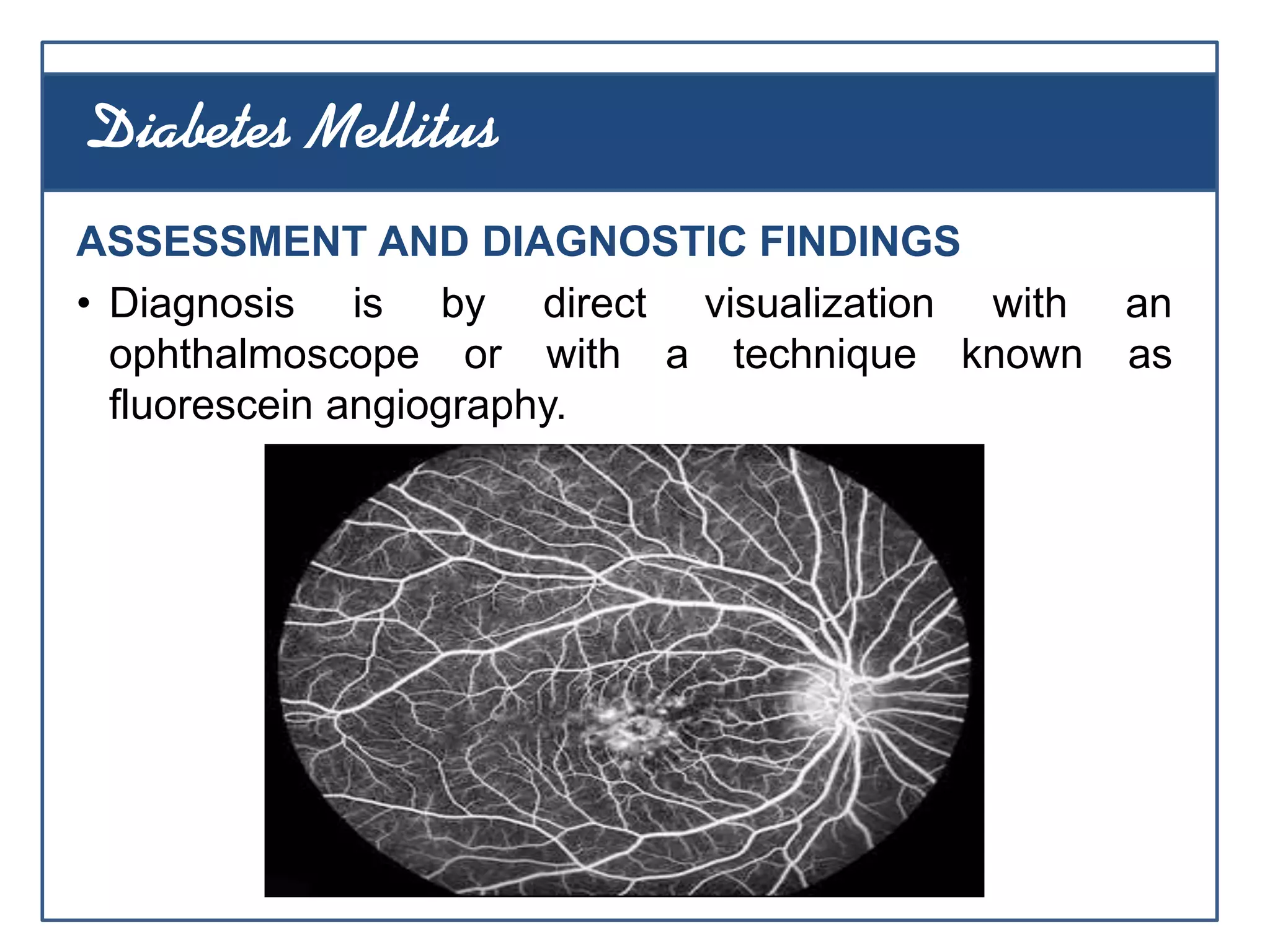 ASSESSMENT AND DIAGNOSTIC FINDINGS
• Diagnosis is by direct visualization with an
ophthalmoscope or with a technique known as
fluorescein angiography.
Diabetes Mellitus
 