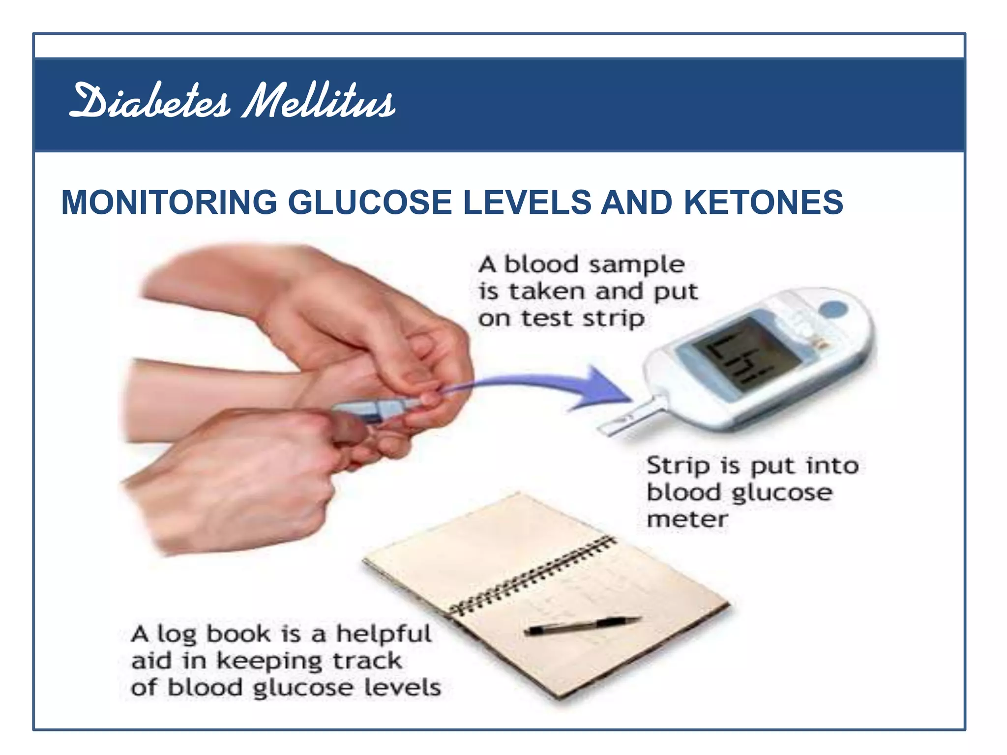 MONITORING GLUCOSE LEVELS AND KETONES
Diabetes Mellitus
 