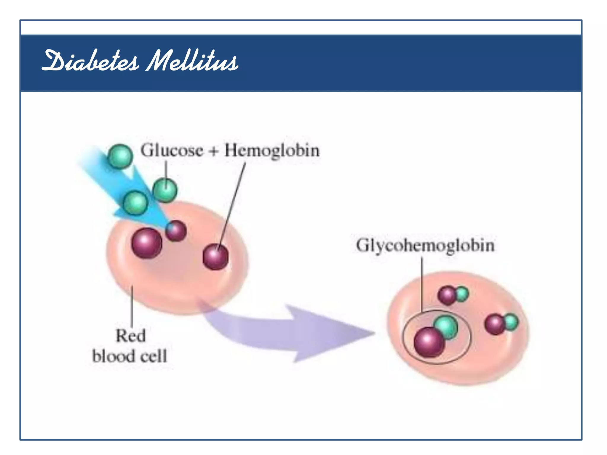 Diabetes Mellitus
 