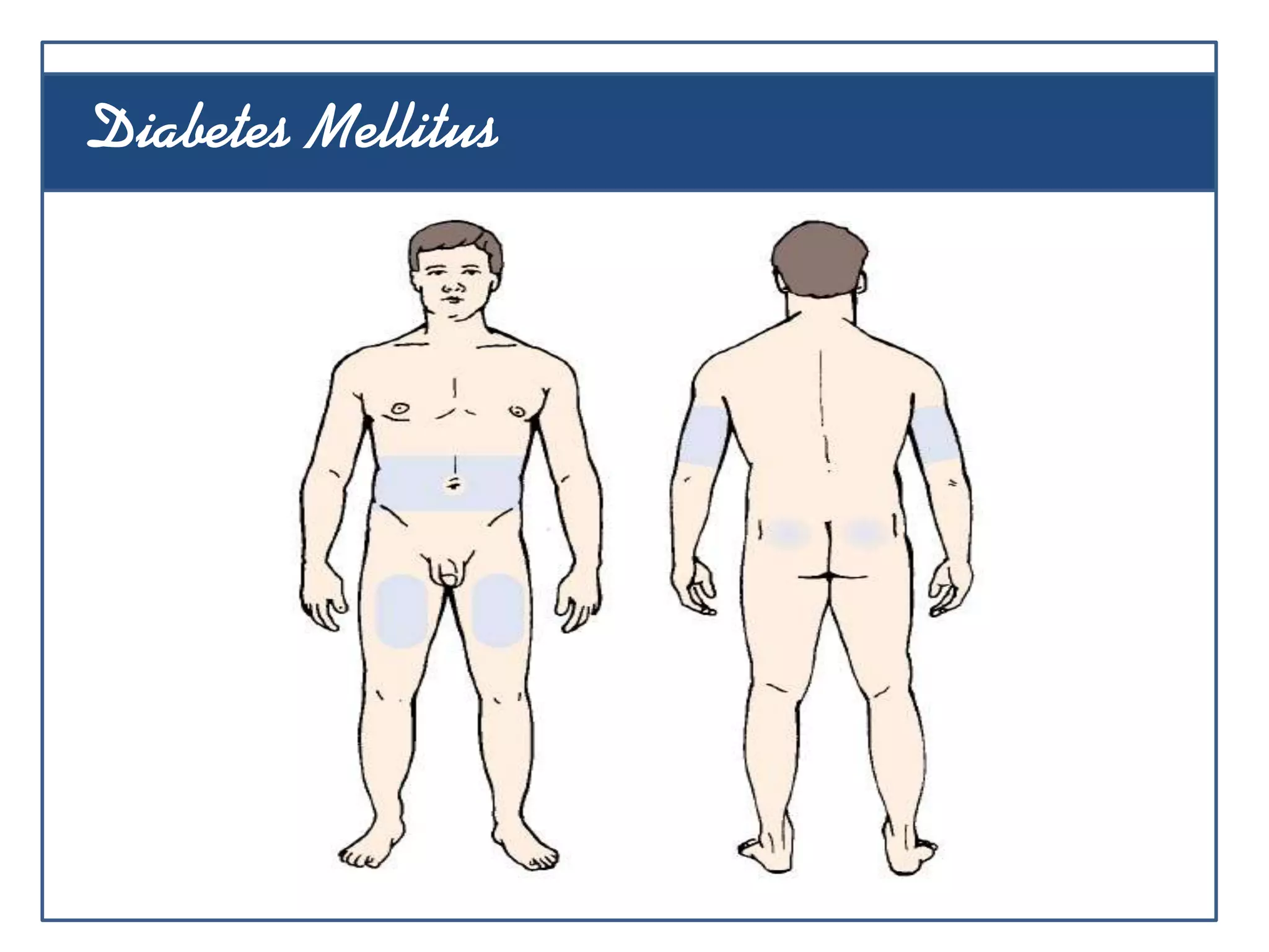 Diabetes Mellitus
 