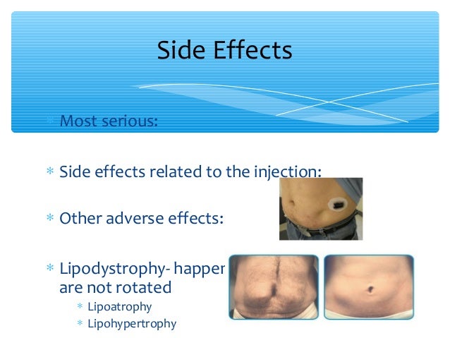 Diabetes lecture fall 2014