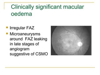 Diabetes melitis & eye part 1 presentation at www.eyenirvaan.com