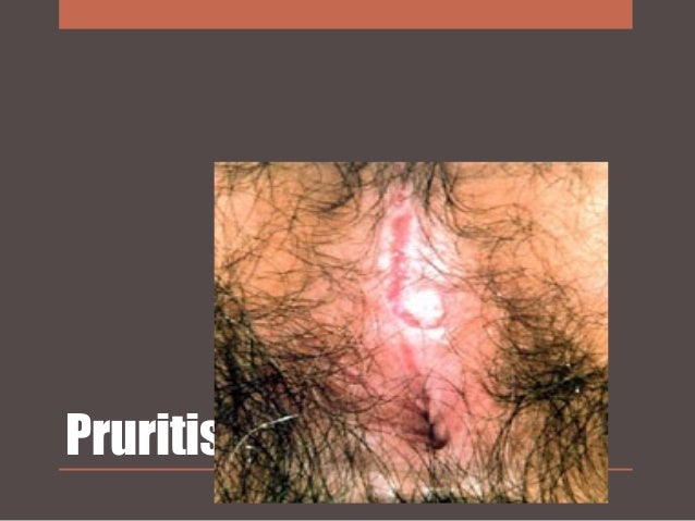 DIABETES MELITUS