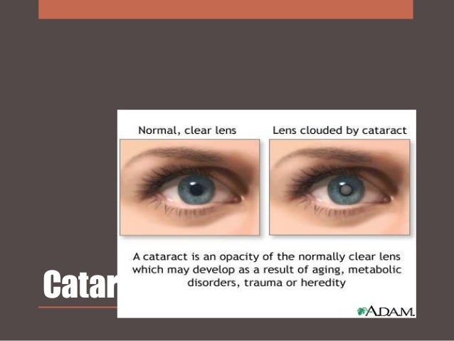 DIABETES MELITUS