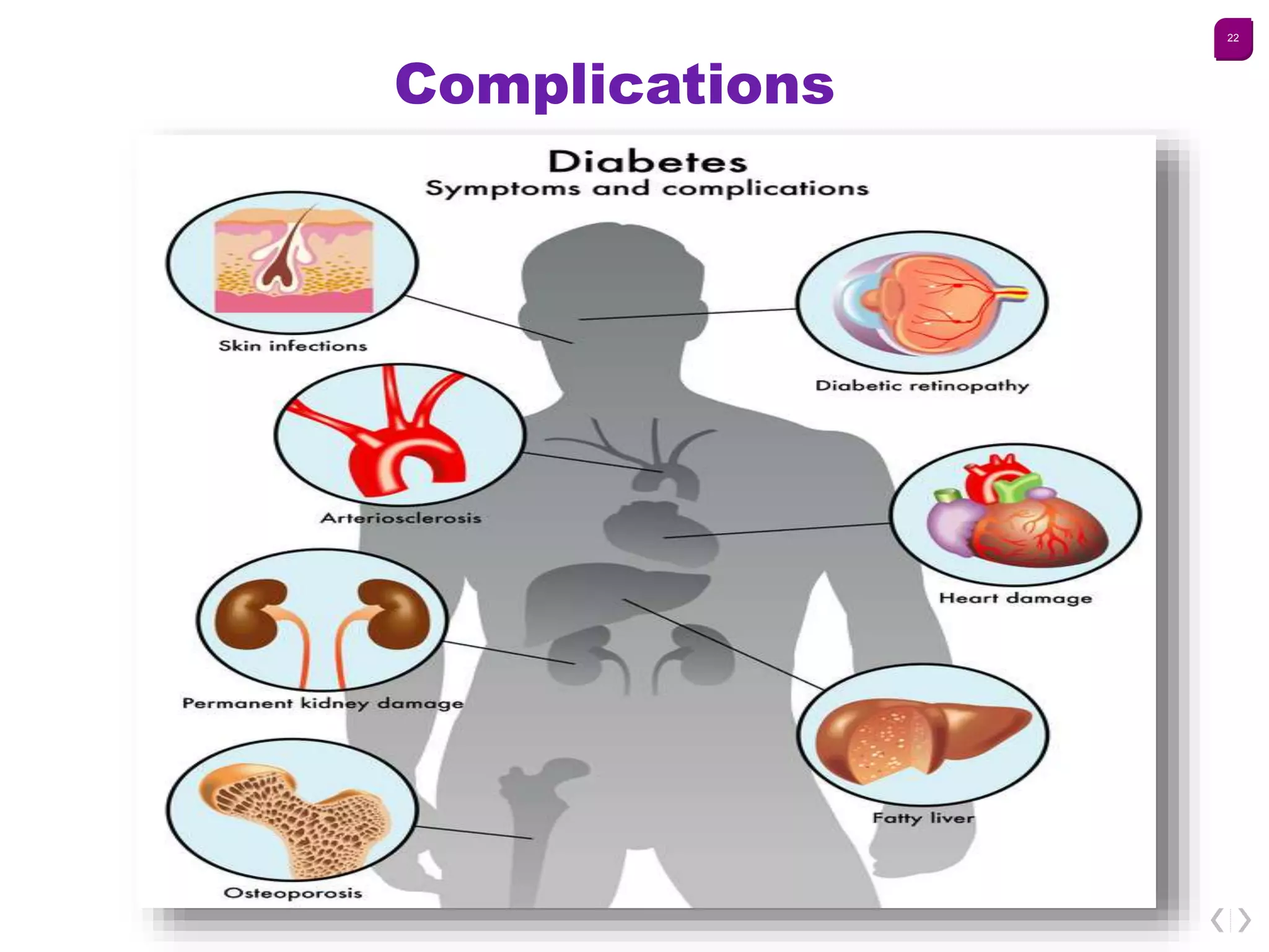 Diabetes mellitus management | PPTX
