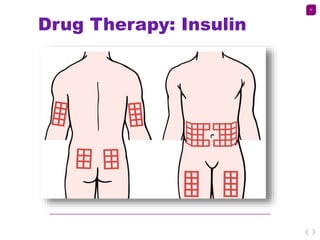 44
Drug Therapy: Insulin
 