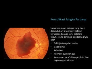Komplikasi Jangka Panjang

Lama-kelamaan glukosa yang tinggi
dalam tubuh bisa menyebabkan
kerusakan banyak saraf didalam
tubuh, resiko tertinggi penderita DM1
ialah
• Sakit jantung dan stroke
• Gagal ginjal
• Kebutaan
• Penyakit gusi dan gigi
• Kerusakan saraf di tangan, kaki dan
    organ-organ lainnya
 