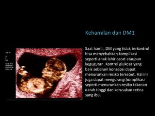 Kehamilan dan DM1

Saat hamil, DM yang tidak terkontrol
bisa menyebabkan komplikasi
seperti anak lahir cacat ataupun
keguguran. Kontrol glukosa yang
baik sebelum konsepsi dapat
menurunkan resiko tersebut. Hal ini
juga dapat mengurangi komplikasi
seperti menurunkan resiko takanan
darah tinggi dan kerusakan retina
sang ibu.
 