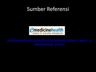 Sumber Referensi




http://www.emedicinehealth.com/slideshow_pictures_type_1_d
                  iabetes/article_em.htm
 