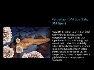 Perbedaan DM tipe 1 dgn
DM tipe 2

Pada DM 1, sistem imun tubuh salah
menyerang ke Pankreas yang
menghasilkan insulin. Pada DM
2, pankreas tidaklah diserang, tapi
karna Insulin tidak diproduksi dgn
cukup. Untuk berbagai alasan tubuh
tidak menggunakan insulin secara
efektif. Gejala pada kedua DM ini
hampir sama, hanya saja pada DM 1
gejala lebih awal tampak pada
penderita
 