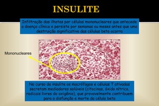 Infiltração das ilhotas por células mononucleares que antecede
a doença clínica e persiste por semanas ou meses antes que uma
destruição significativa das células beta ocorra
Infiltração das ilhotas por células mononucleares que antecede
a doença clínica e persiste por semanas ou meses antes que uma
destruição significativa das células beta ocorra
INSULITE
No curso da insulite os macrófagos e células T ativadas
secretam mediadores solúveis (citocinas, óxido nítrico,
radicais livres do oxigênio), que provavelmente contribuem
para a disfunção e morte da célula beta
Mononucleares
 