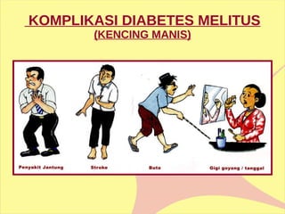 KOMPLIKASI DIABETES MELITUS  (KENCING MANIS) 