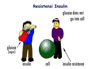 Resistensi Insulin 