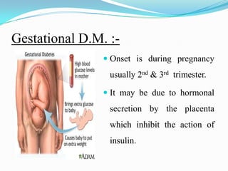 Gestational D.M. :-Onset is during pregnancy usually 2nd & 3rd  trimester.It may be due to hormonal secretion by the placenta which inhibit the action of insulin.