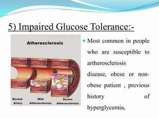 5) Impaired Glucose Tolerance:-Most common in people who are susceptible to artherosclerosis disease, obese or non-obese patient , previous history of hyperglycemia, 