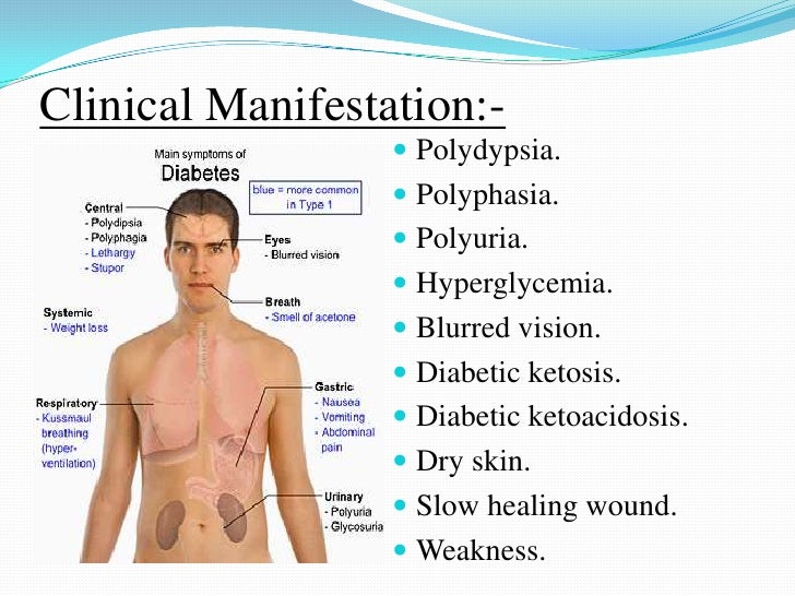 what is clinical presentation of diabetes mellitus