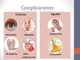 Complicaciones
          Crónicas                Agudas




Retinopatía       Nefropatía     Hipoglucemia




Pie diabético    Daño            Cetoacidosis
                cardiovascular
 