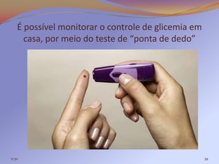 É possível monitorar o controle de glicemia em
      casa, por meio do teste de “ponta de dedo”




11:30                                                39
 
