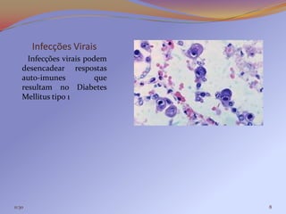 Infecções Virais
      Infecções virais podem
    desencadear respostas
    auto-imunes           que
    resultam no Diabetes
    Mellitus tipo 1




11:30                           8
 
