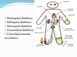  Retinopatía diabética
 Nefropatía diabética
 Neuropatía diabética
 Cetoacidosis diabética
 Coma hiperosmolar
no cetósico
 