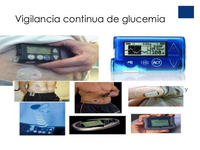 Criterios Diagnosticos de Diabetes mellitus Criterios Diagnosticos de Diabetes mellitus