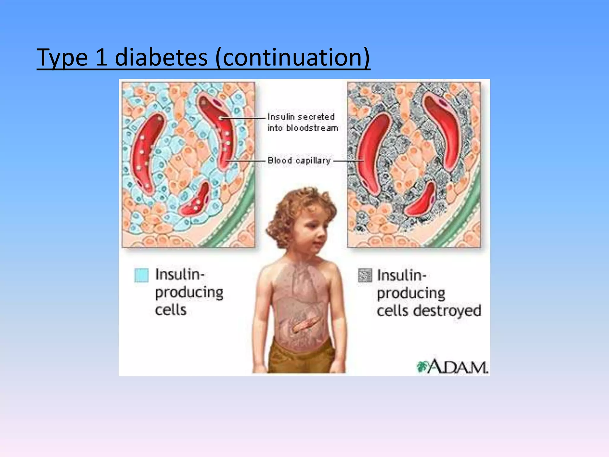 Diabetes mellitus definition classification clinical features pptx