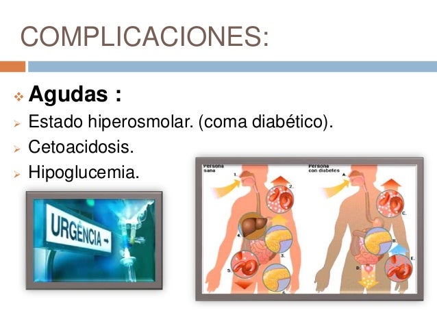 Diabetes mellitus Diabetes mellitus
