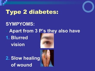 SYMPYOMS:
• Apart from 3 P’s they also have
1. Blurred
vision
2. Slow healing
of wound
Type 2 diabetes:
 