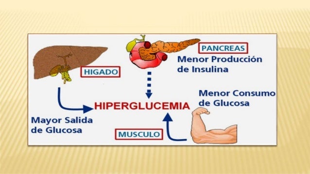 Diabetes mellitus Diabetes mellitus