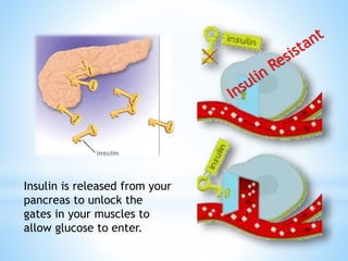 Insulin is released from your 
pancreas to unlock the 
gates in your muscles to 
allow glucose to enter. 
 