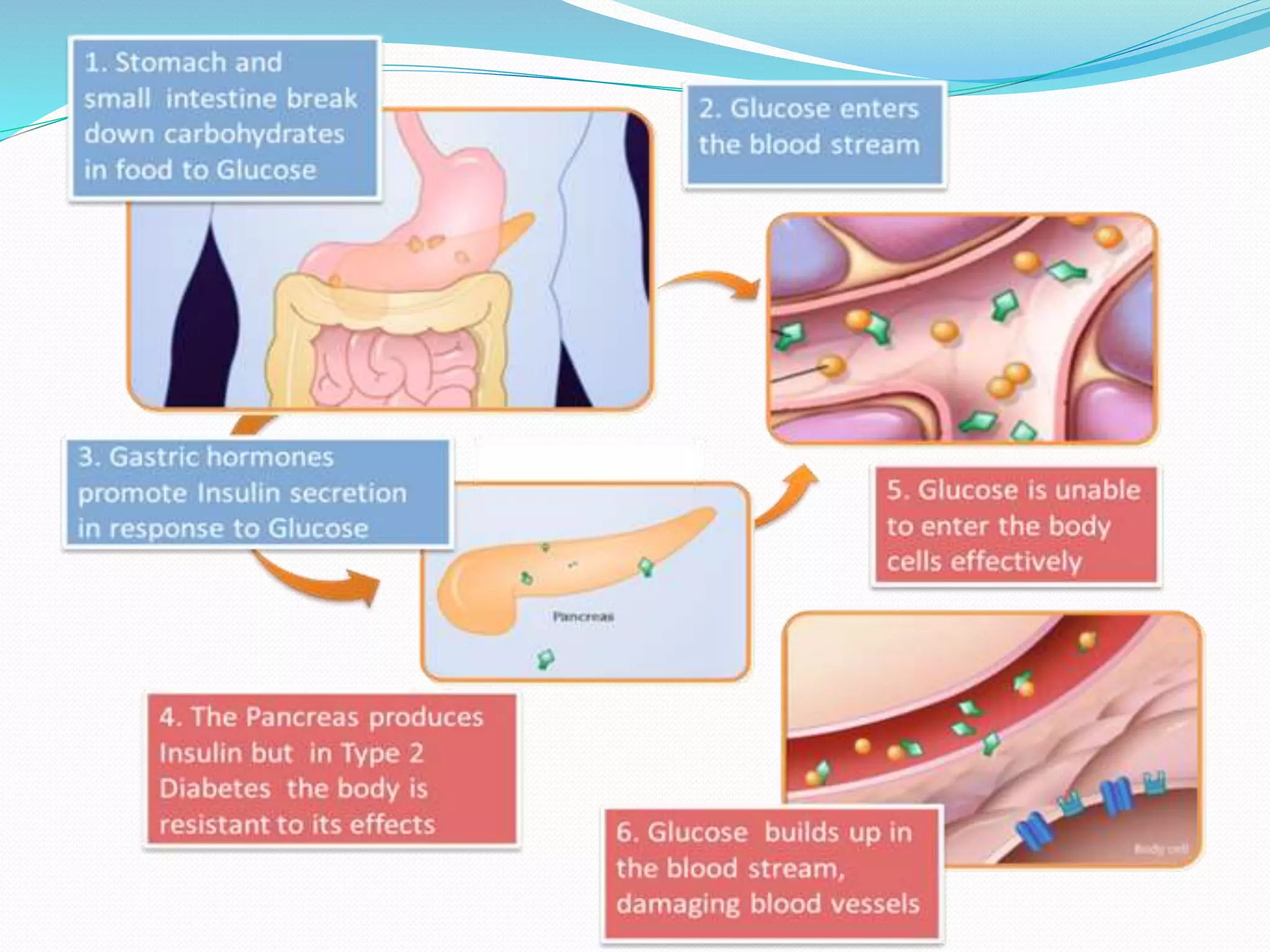 Diabetes mellitus | PPTX