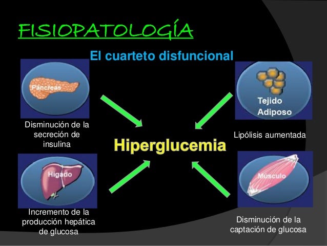 Diabetes mellitus Diabetes mellitus