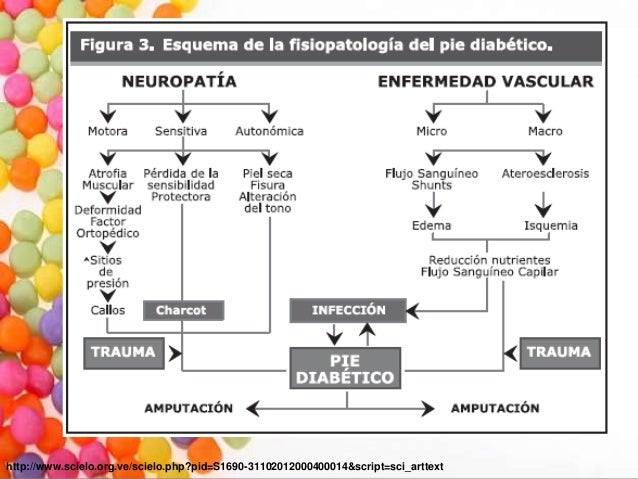 Diabetes mellitus Diabetes mellitus