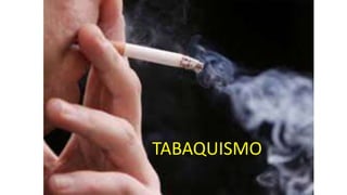 TABAQUISMO
 