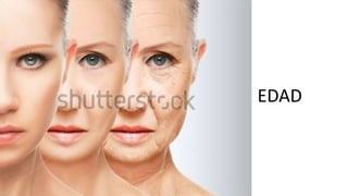 EDAD
 
